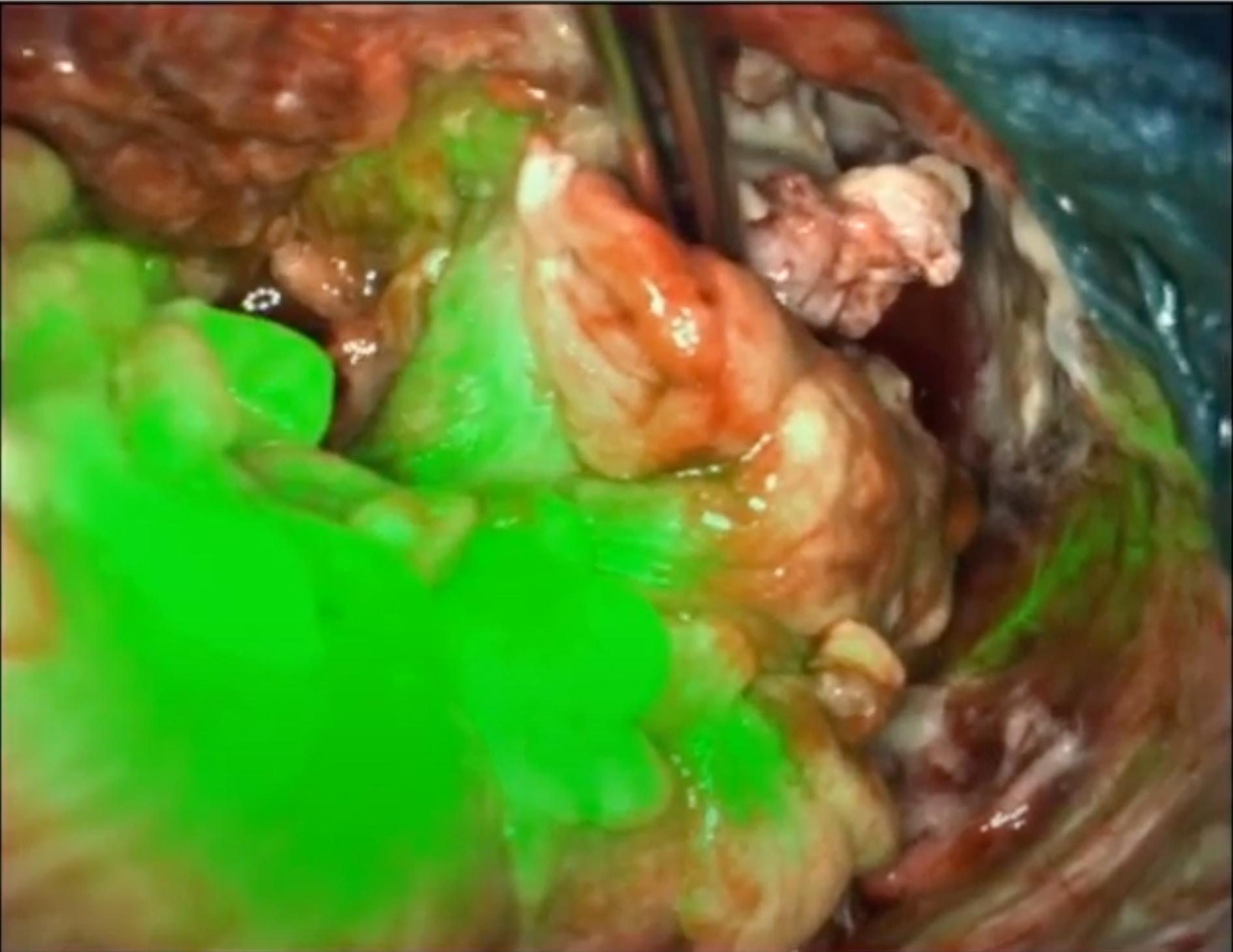 Surgimab collaboration